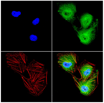 PTPN14 Antibody