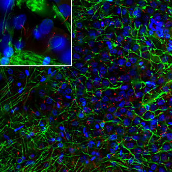 Adenylate Cyclase III/ADCY3 Antibody