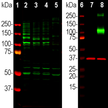 Adenylate Cyclase III/ADCY3 Antibody