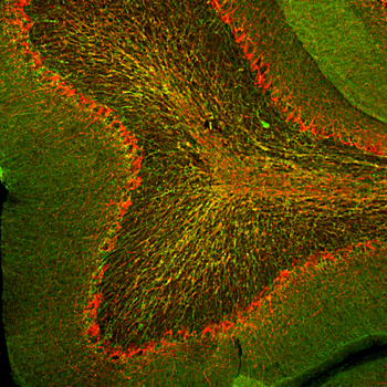 CNP/CNPase Antibody