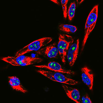 Fibrillarin Antibody