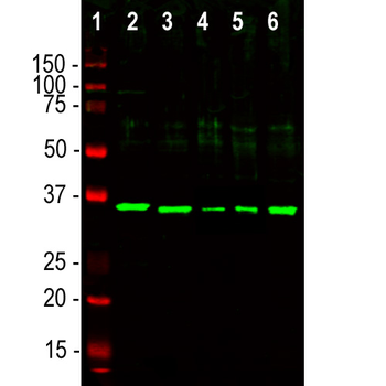 Fibrillarin Antibody