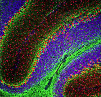 FOX2 Antibody