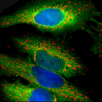 HSP27/HSBP1 Antibody