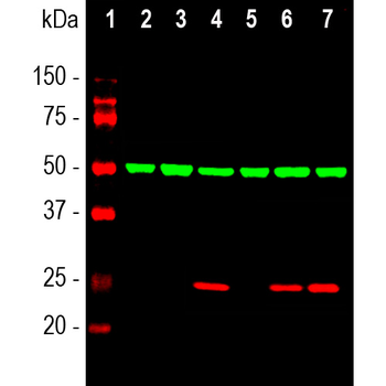 HSP27/HSBP1 Antibody