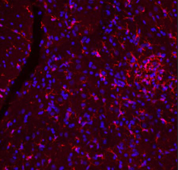 IBA1 Antibody