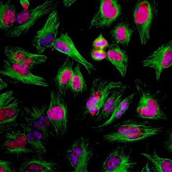 Ki67 Antibody