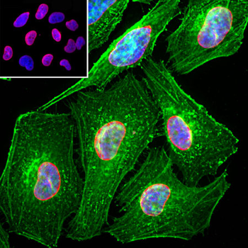 Lamin A/C Antibody