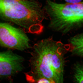MARCKS (Myristoylated Alanine Rich C Kinase Substrate) Antibody