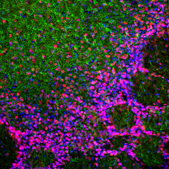 MeCP2 (Methyl-CpG Binding Protein 2) Antibody