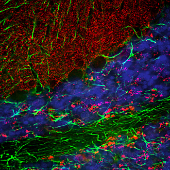 alpha Synuclein Antibody