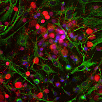 PGP9.5/UCHL1 Antibody