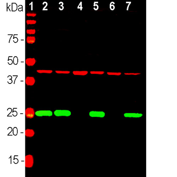 PGP9.5/UCHL1 Antibody