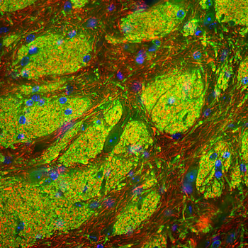 CNP/CNPase Antibody