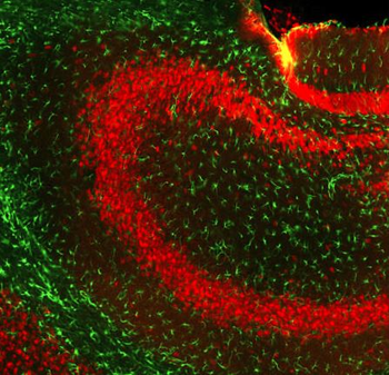 GFAP Antibody