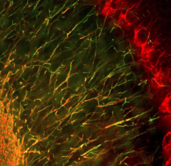 Neurofilament NF-H Antibody
