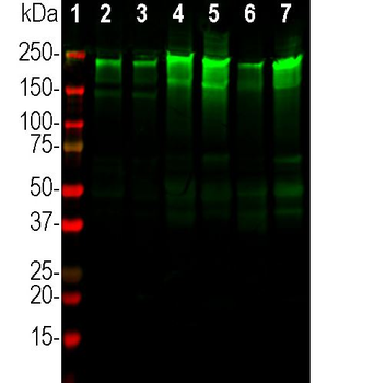 Neurofilament NF-H Antibody