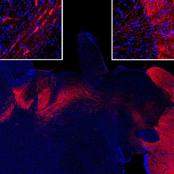Tyrosine Hydroxylase Antibody