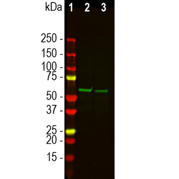 Tyrosine Hydroxylase Antibody