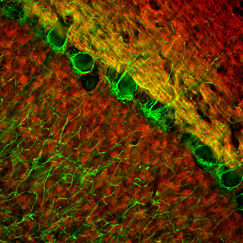 Neurofilament NF-L Antibody