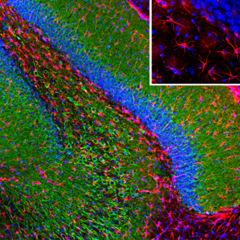 GFAP Antibody