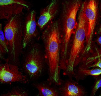 Annexin A6 Antibody