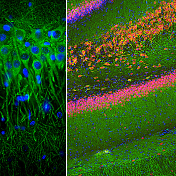 MAP2 (Microtubule Associated Protein 2) Antibody