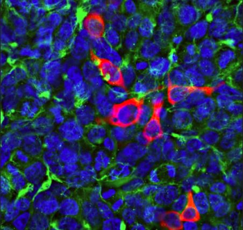 CasΦ/Cas12j Antibody