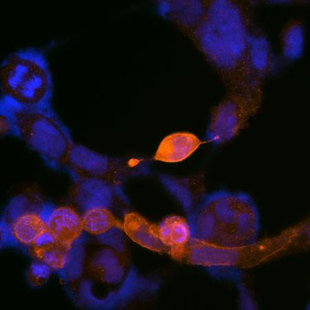 Kappa Opioid Receptor Antibody