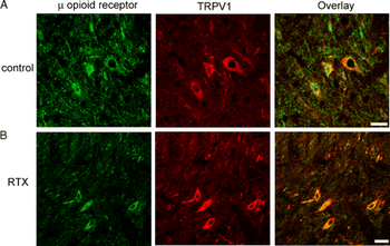 Mu Opioid Receptor Antibody