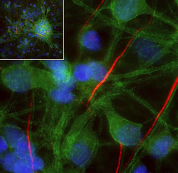 alpha-II-Spectrin/alpha-Fodrin Antibody