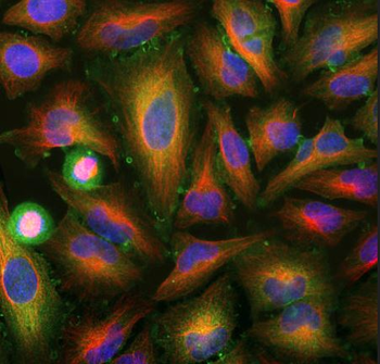 Annexin A6 Antibody