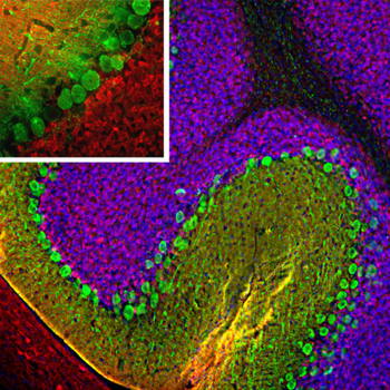 Calretinin Antibody