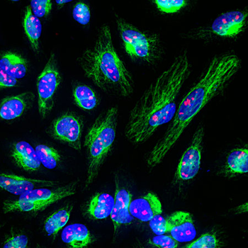 Fibrillarin Antibody