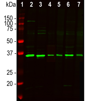 Fibrillarin Antibody