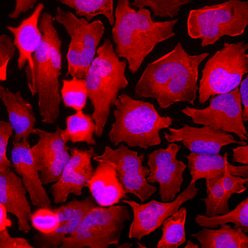 GAPDH Antibody