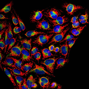 HSP60 (Heat Shock Protein 60) Antibody