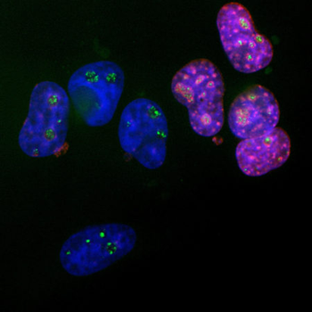Ki67 Antibody
