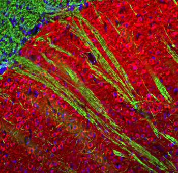 MAP2 (Microtubule Associated Protein 2) Antibody