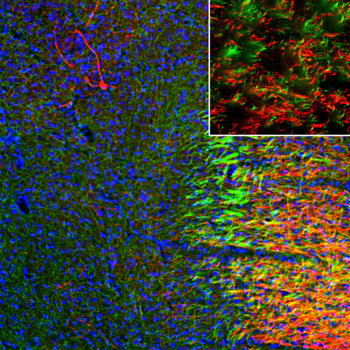 5HT (Serotonin) Transporter Antibody