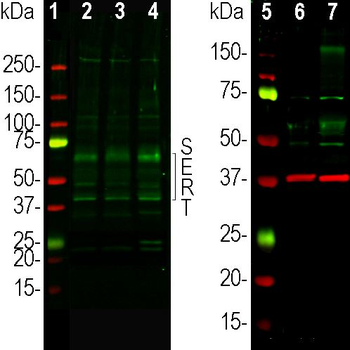 5HT (Serotonin) Transporter Antibody