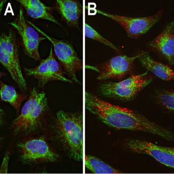 Ubiquitin Antibody