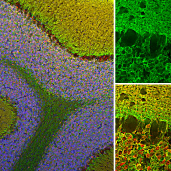 Visinin-Like Protein 1/VSNL 1 Antibody