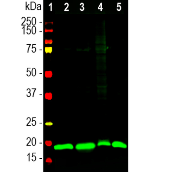 Visinin-Like Protein 1/VSNL 1 Antibody