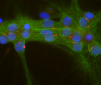 Adenylate Cyclase III/ADCY3 Antibody