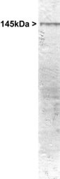 Adenylate Cyclase III/ADCY3 Antibody