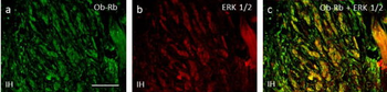 LepRb/OBRb Antibody