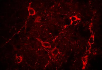 LepRb/OBRb Antibody