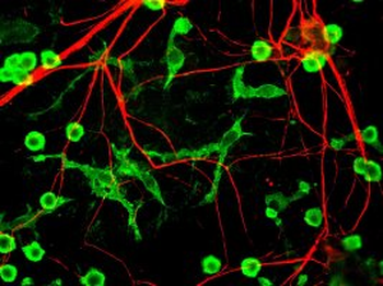 Neurofilament alpha-internexin/NF66 Antibody