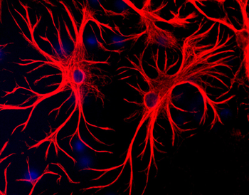 GFAP Antibody